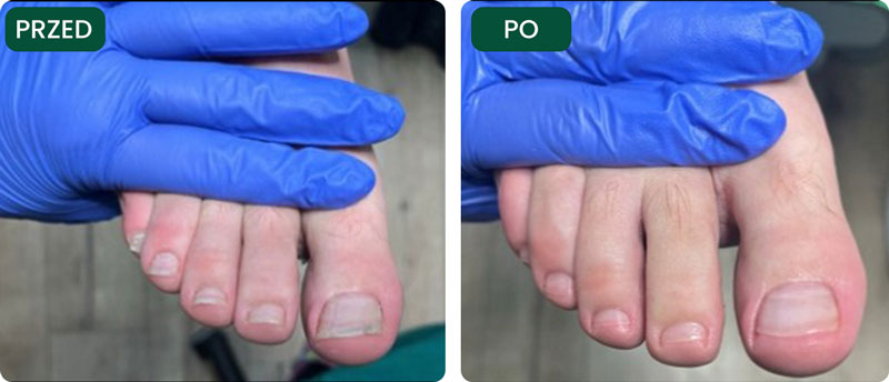 opracowanie paznokci